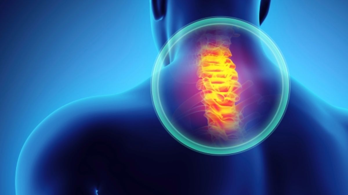 Cervical Microdiscectomy
