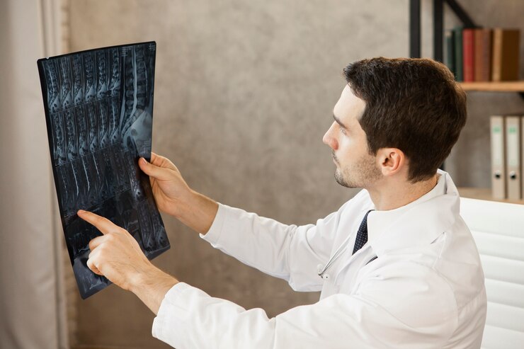 Spinal Fractures 