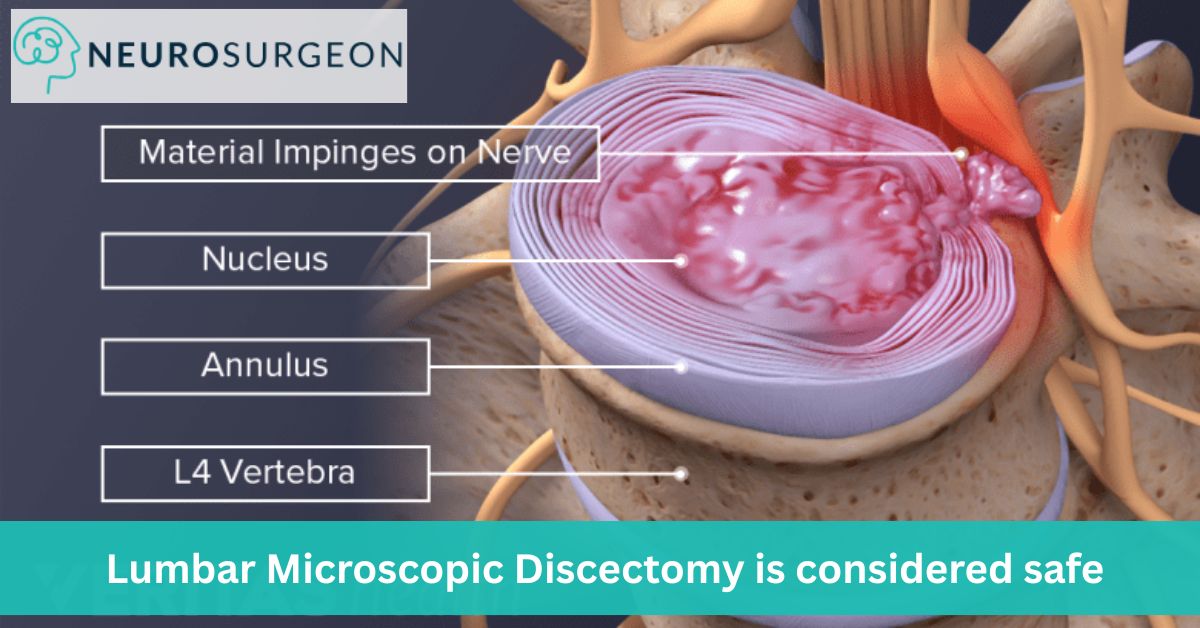 lumbar microscopic discectomy by Dr Amit Deora a Top Neurologist in Indore