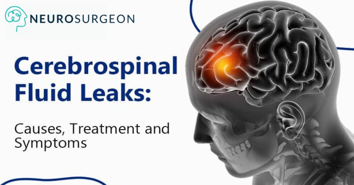 Cerebrospinal-Fluid-Disorder - Dr Amit Deora - Best Neurologist Doctor In Indore