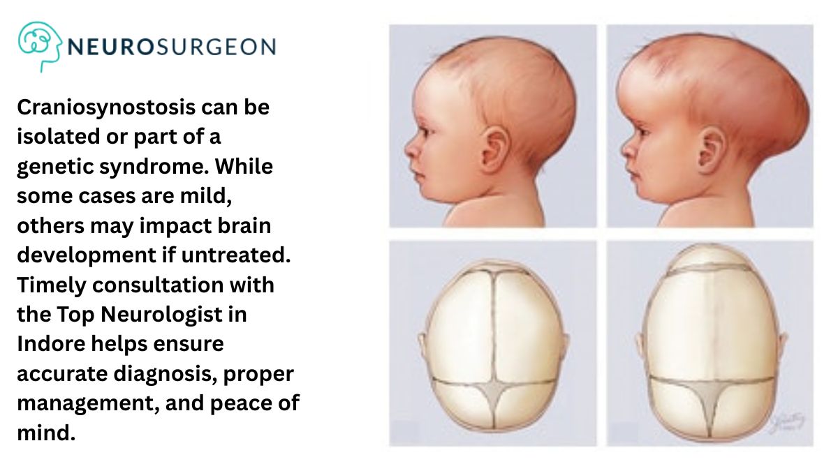 Craniosynostosis by Dr Amit Deora aTop Neurologist In Indore