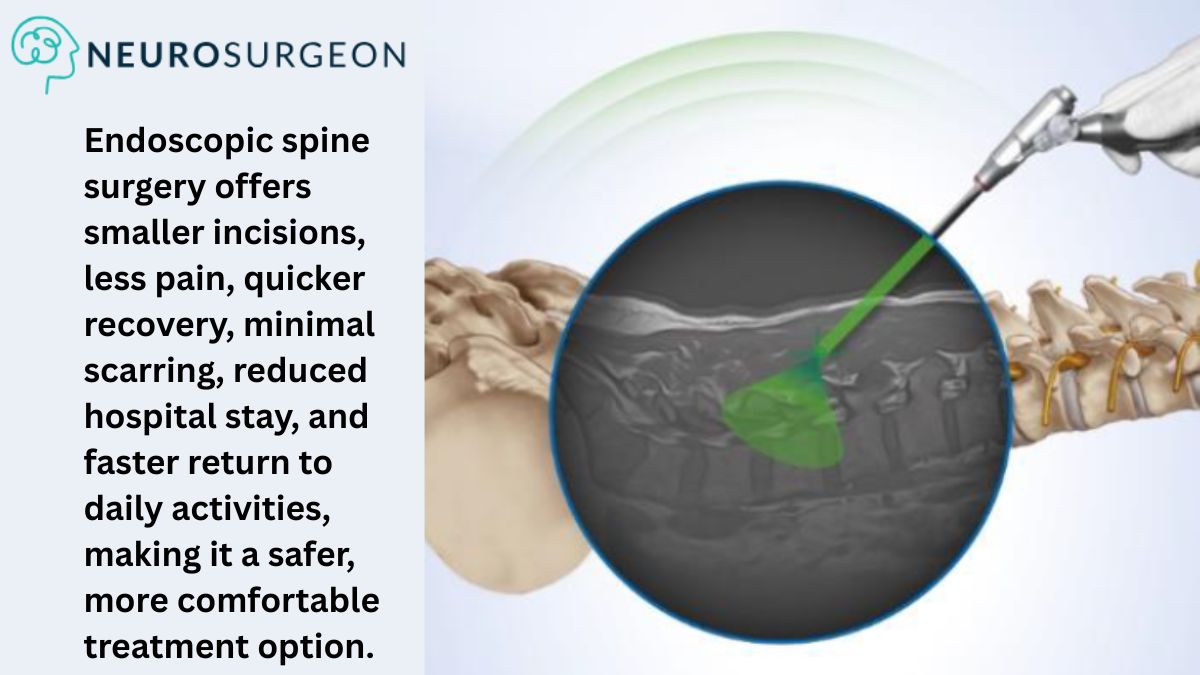 Endoscopic Spine Surgery - Dr Amit Deora a leading Neurosurgeon In Indore