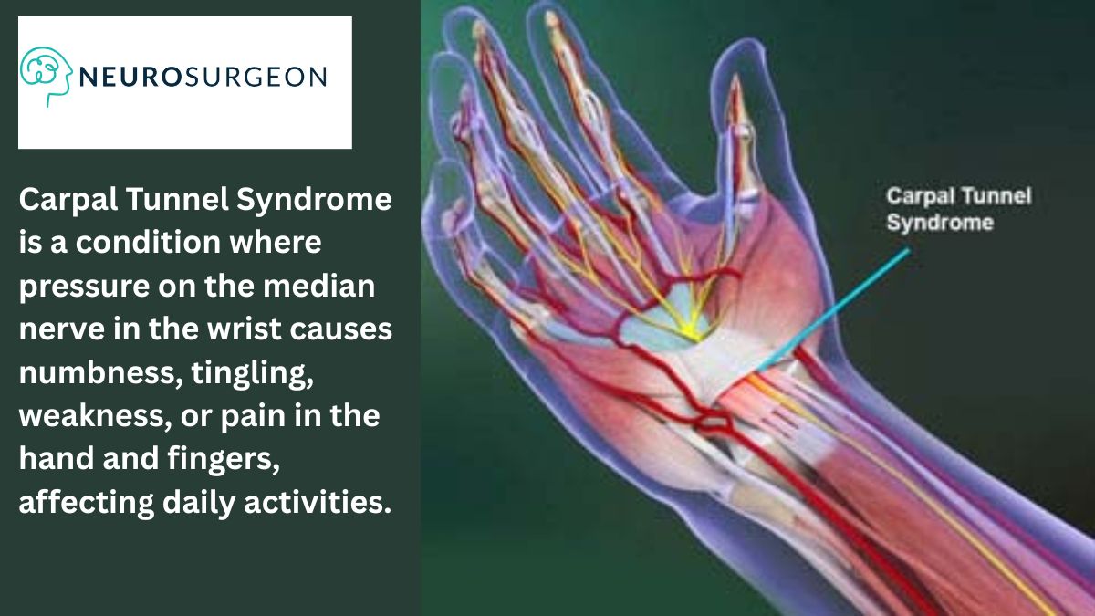 carpal-tunnel-syndrom - Dr Amit Deora - Neurosurgeon Indore