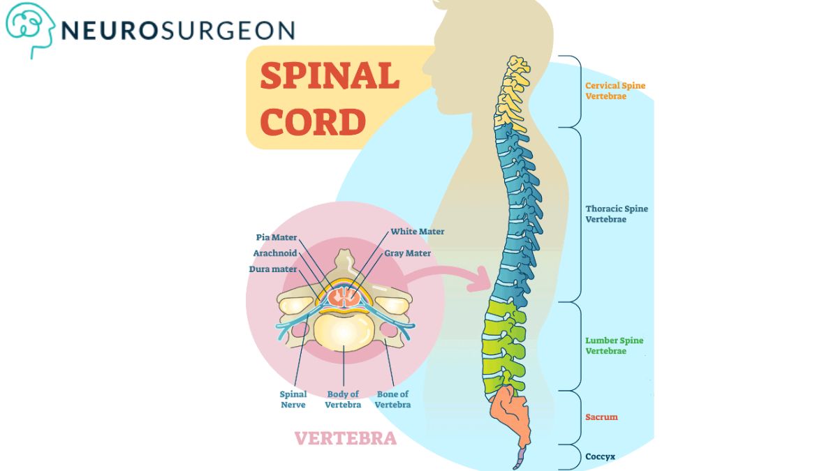 Spinal Tumor - Dr Amit Deora - Best Neurologist In Indore