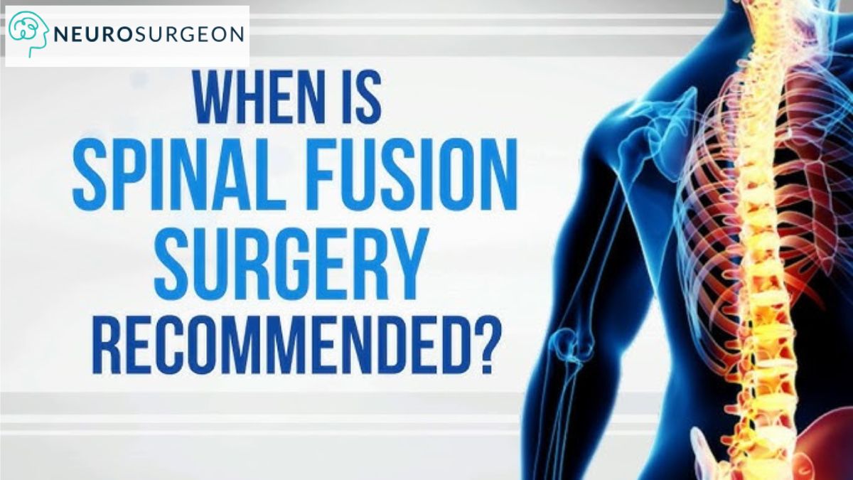Spine Surgery By Dr Amit Deora - Best Spine Surgeon In Indore (1)