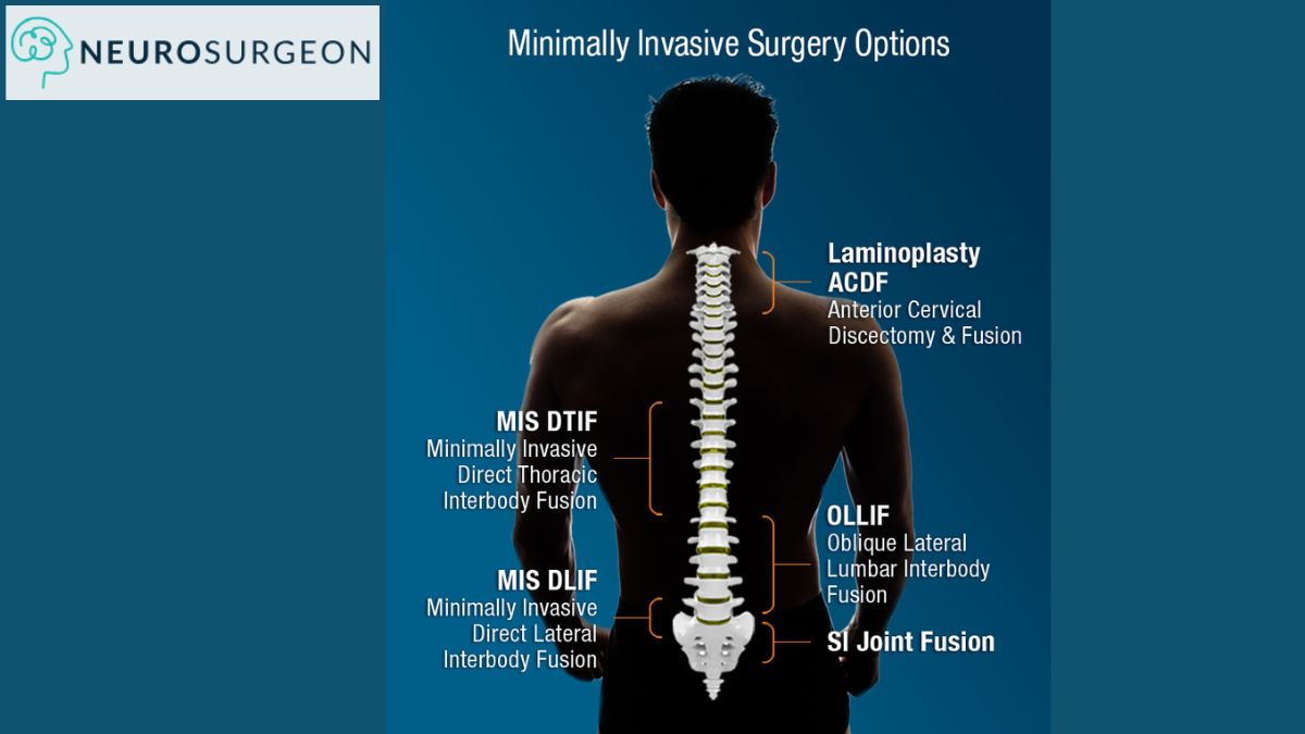 Spine Surgery By Dr Amit Deora - Best Spine Surgeon In Indore (2)