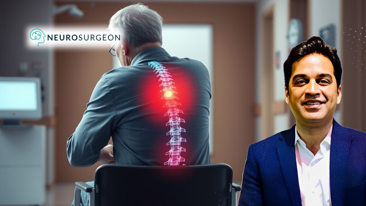 Doctors Who Treat Spinal Cord Tumors