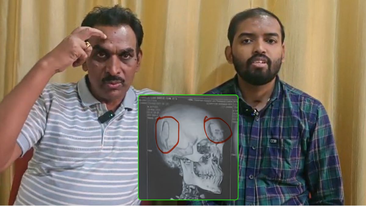 सिर में चोट के बाद क्या होता है - Neurosurgeon Dr. Amit Deora