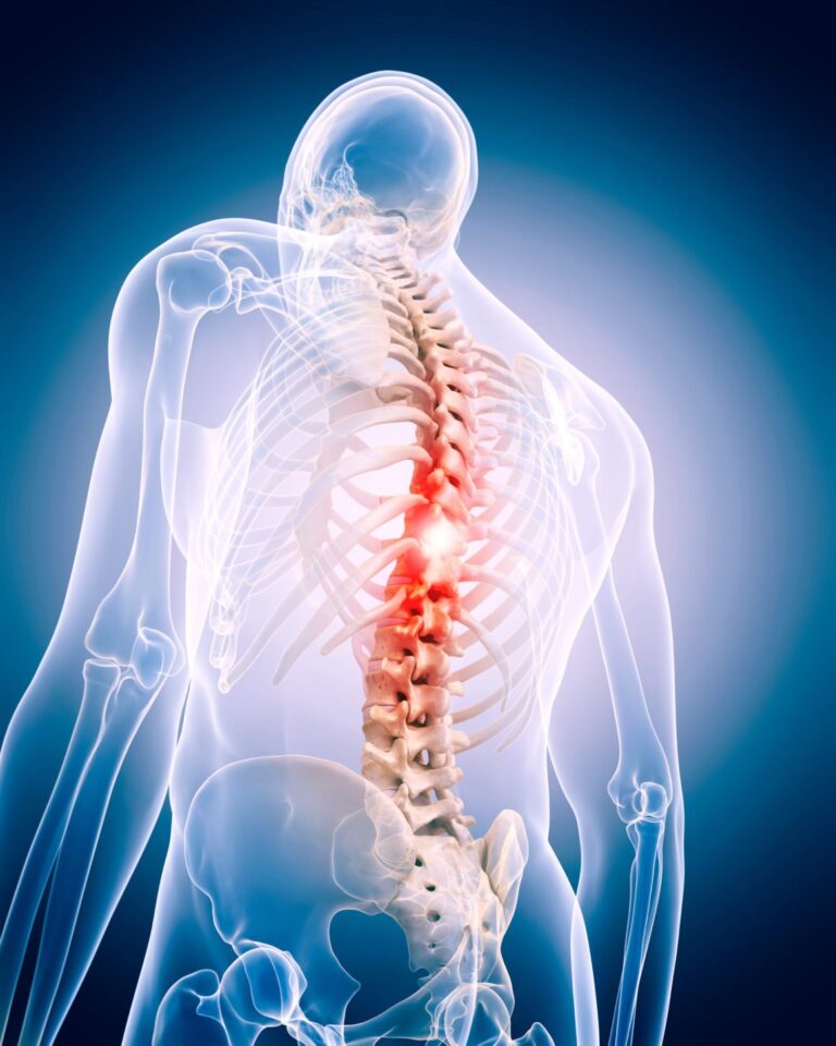 Minimally Invasive Spine Surgery