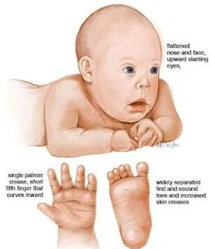 birth defect paediatric