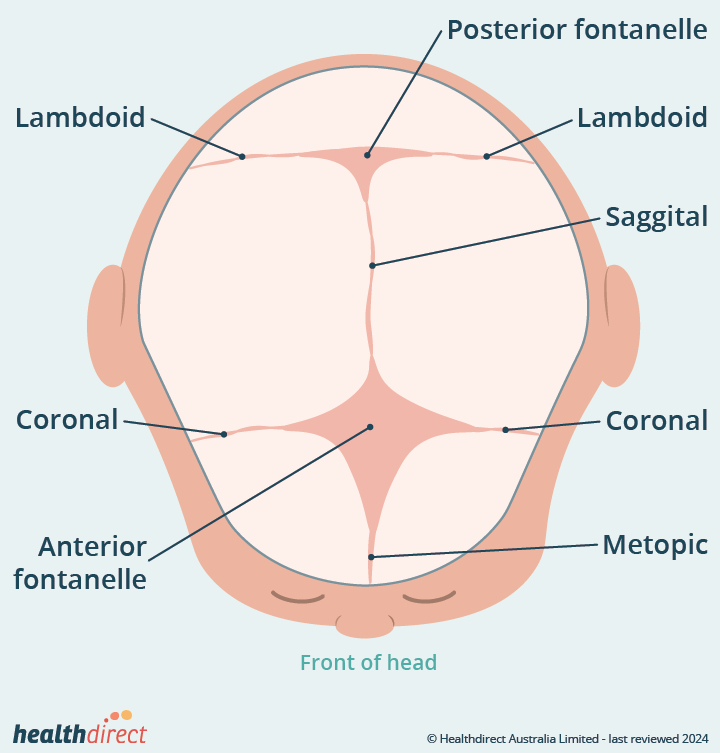 Craniosynostosis