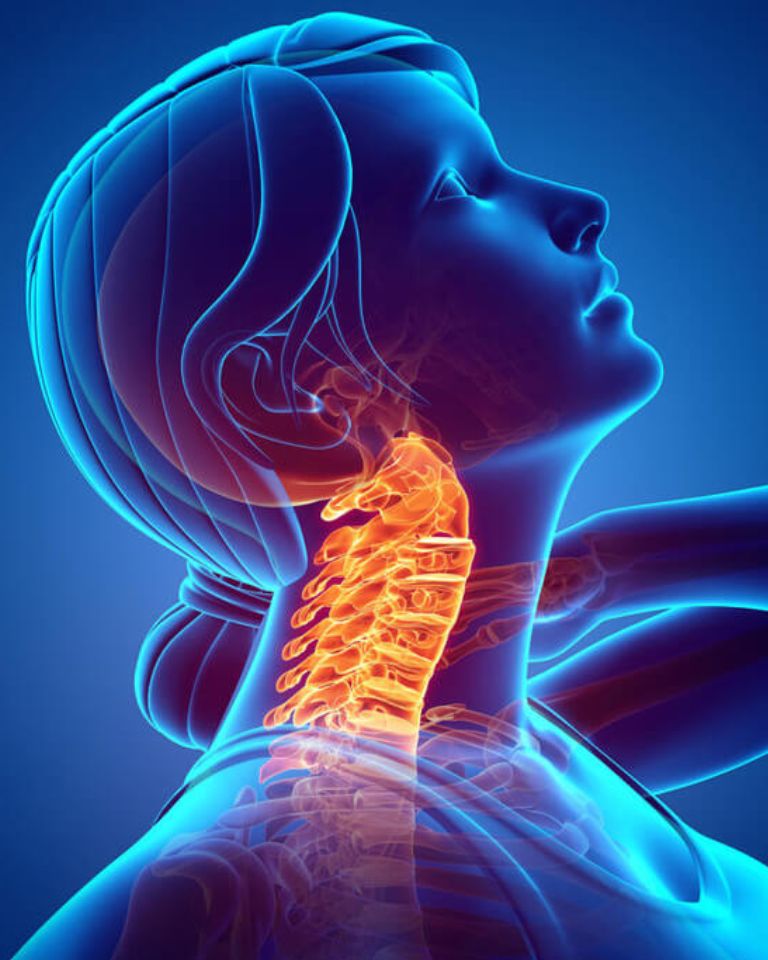 Cervical Microdiscectomy