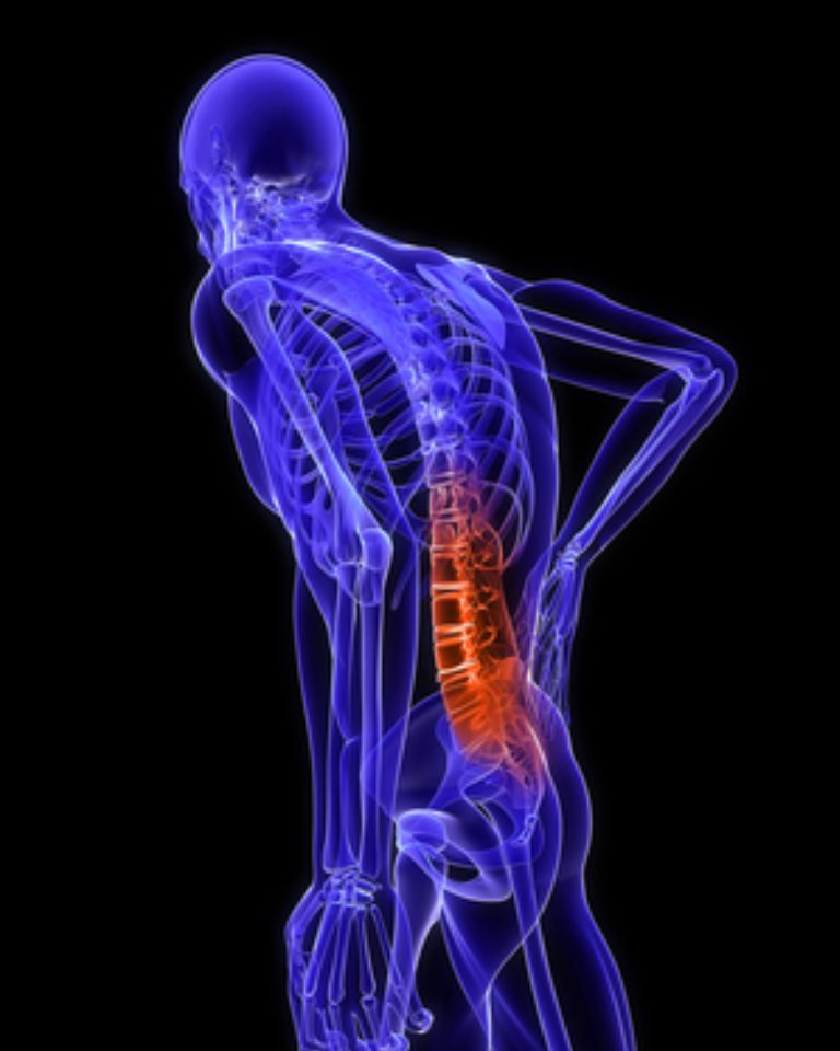 Lumbar Microscopic Discectomy