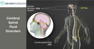 CSF Disorders by Dr Amit Deora a best neurologist in indore