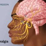 Brain Neuralgia - Dr Amit Deora - Best Neurosurgeon In Indore