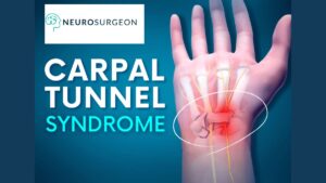 carpal-tunnel-syndrome by Dr Amit Deora - neurosurgeon indore