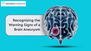 Brain Aneurysm Dr Amit Deora Best Neurologist Doctor in Indore