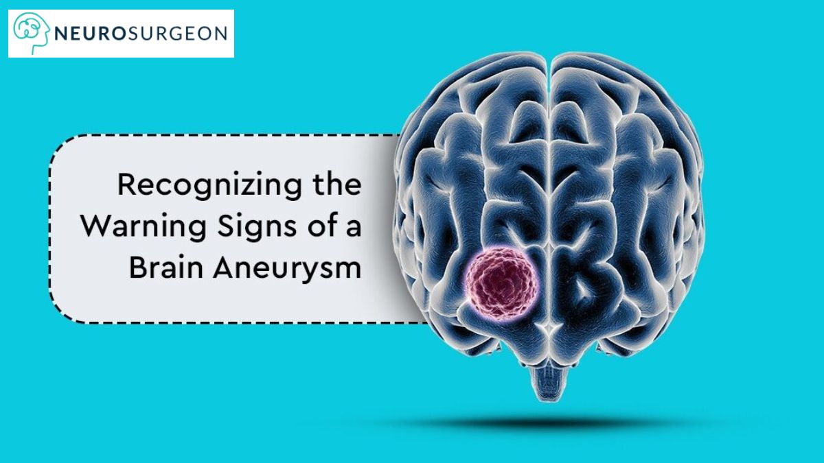Brain Aneurysm Dr Amit Deora Best Neurologist Doctor in Indore