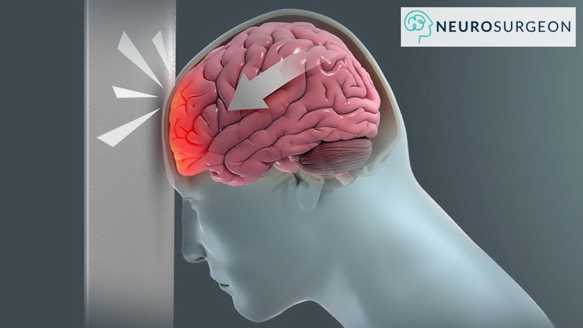 Head Injury - Dr Amit Deora - Best Neurologist in Indore