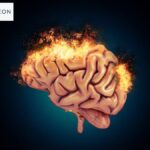 Neurosurgeon - Dr Amit Deora - Neurologist In Indore