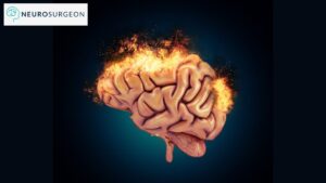 Neurosurgeon - Dr Amit Deora - Neurologist In Indore