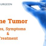Spinal-tumor- Dr Amit Deora - Best Neurologist In Indore