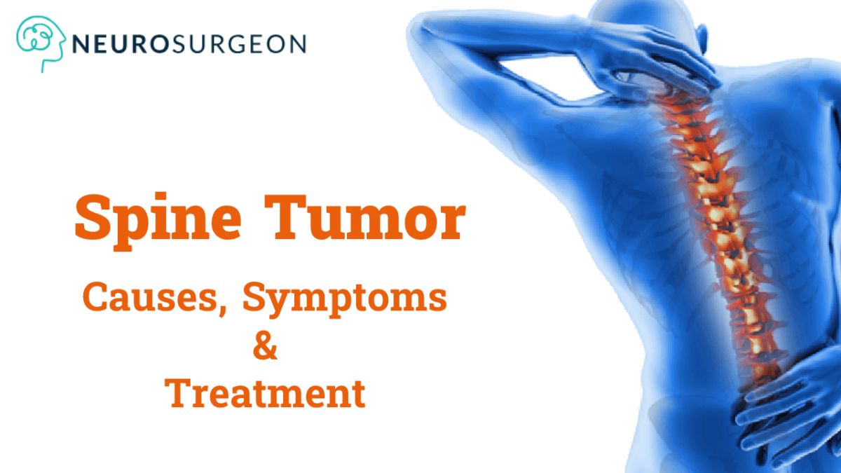 Spinal-tumor- Dr Amit Deora - Best Neurologist In Indore