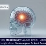 How Head Injury Causes Brain Tumor Insights from the Best Neurosurgeon in Indore Dr. Amit Deora