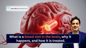 Know Important information about blood clot in the brain from neurosurgeon Dr. Amit Deora