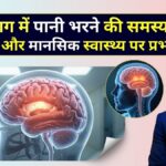 ब्रेन में पानी भरना (हाइड्रोसिफ़लस) की समस्या शरीर और मानसिक स्वास्थ्य पर प्रभाव - Neurosurgeon Dr. Amit Deora