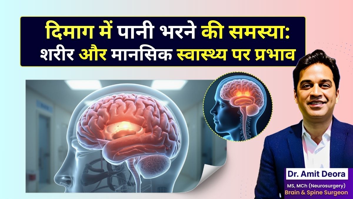 ब्रेन में पानी भरना (हाइड्रोसिफ़लस) की समस्या शरीर और मानसिक स्वास्थ्य पर प्रभाव - Neurosurgeon Dr. Amit Deora