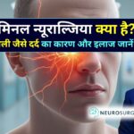 ट्राइजेमिनल न्यूराल्जिया स्पेशलिस्ट डॉ. अमित देवड़ा