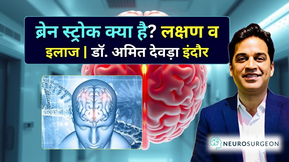बेस्ट ब्रेन स्ट्रोक डॉक्टर अमित देवड़ा से।