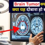 ब्रेन में ट्यूमर क्यों होता है
