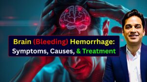 Brain Hemorrhage Guide Causes, Warning Signs, Effects on Memory