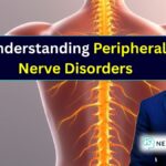 Peripheral Nerve Injury Treatment Everything You Need to Know - Dr Amit Deora Best Neurologist Doctor in Indore