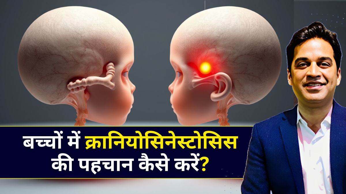 बच्चों में क्रानियोसिनेस्टोसिस