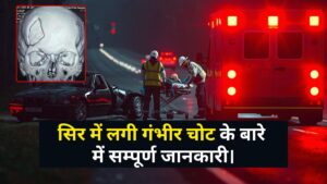 सिर में चोट के बाद क्या होता है याददाश्त, भविष्य की समस्याएं और इलाज का पूरा सच