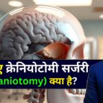 क्रेनियोटोमी सर्जरी क्या है - Dr Amit Deora Best Neurologist Doctor in Indore