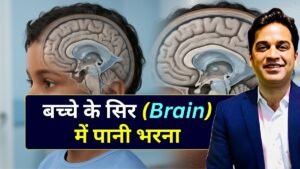 बच्चे के सिर में पानी भरना - Dr Amit Deora Best Neurologist in Indore