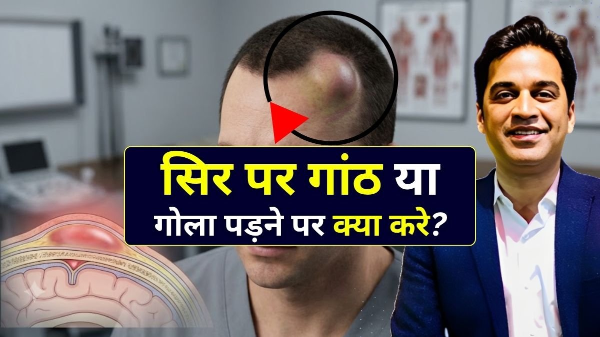 सिर पर गांठ पड़ने पर क्या करें