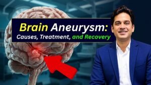 Brain Aneurysm Treatment in Indore Symptoms, and Treatment